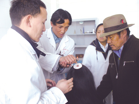 藏医特色金针疗法