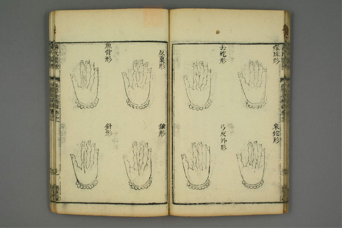 陈氏小儿痘疹方论(第52页)