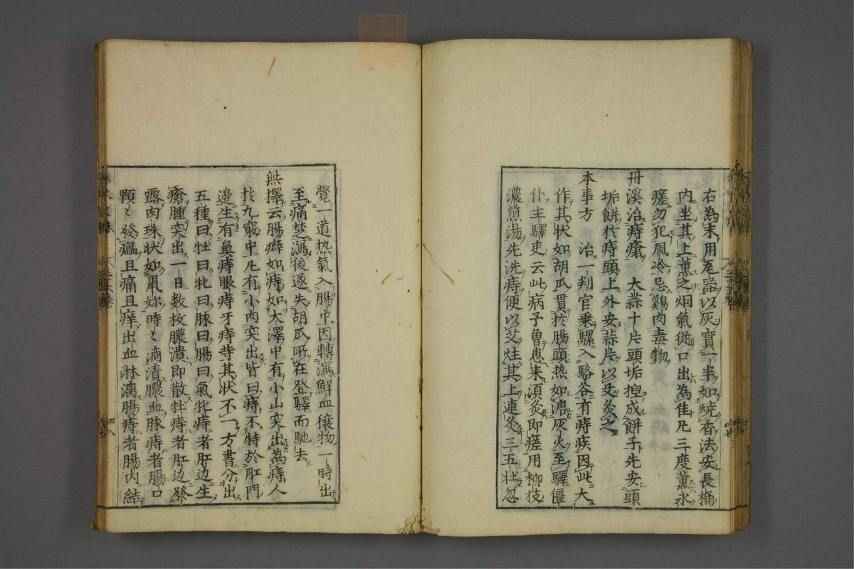 赤水玄珠(医案.第37-50卷)(第49页)