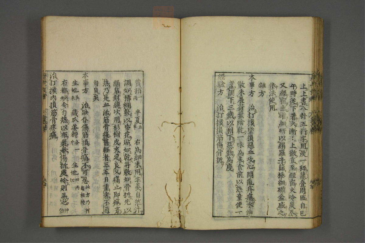 赤水玄珠(医案.第37-50卷)(第65页)