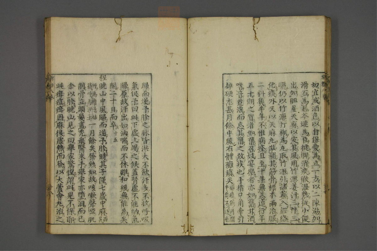 赤水玄珠(医案.第37-50卷)(第448页)