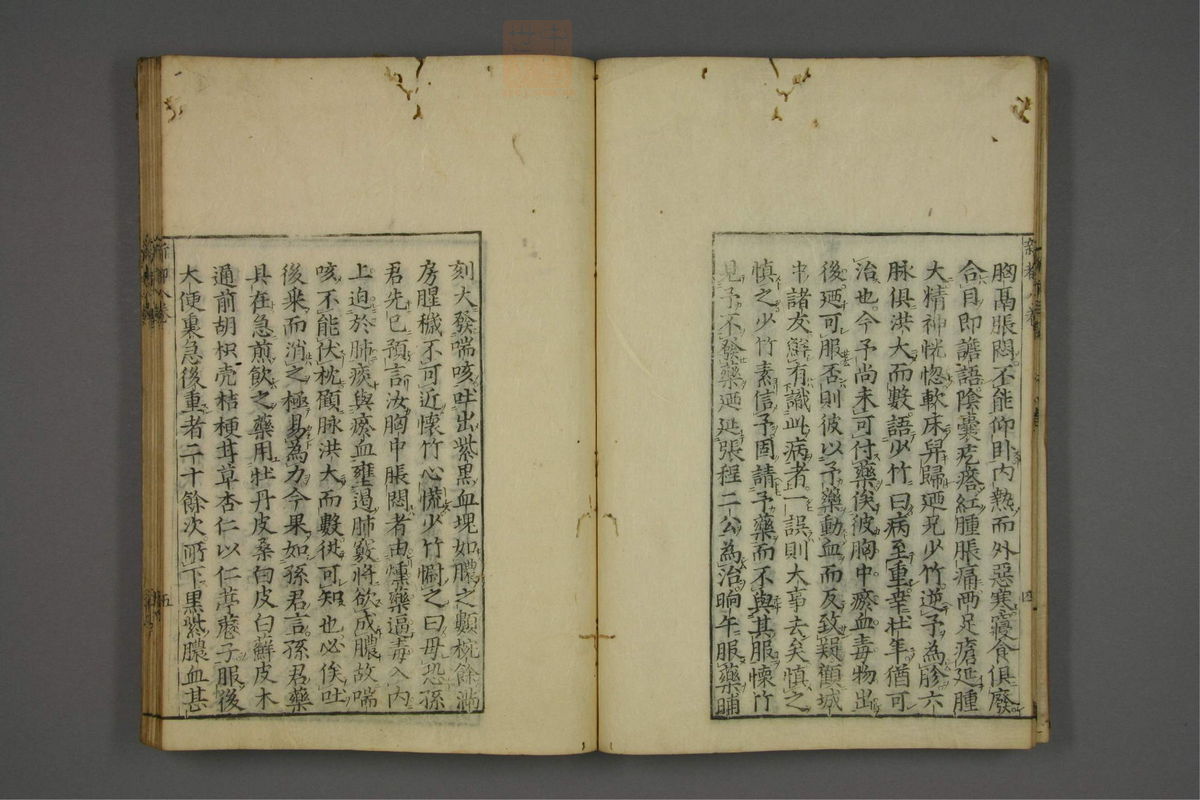 赤水玄珠(医案.第37-50卷)(第435页)