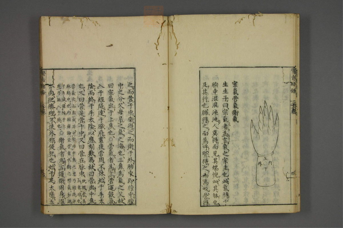 赤水玄珠(医案.第37-50卷)(第565页)