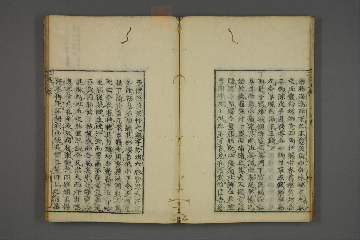 赤水玄珠(医案.第37-50卷)(第180页)