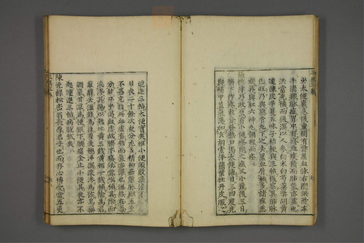 赤水玄珠(医案.第37-50卷)(第215页)