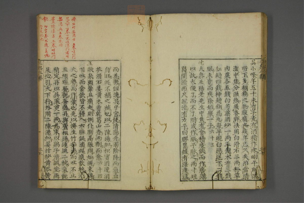 赤水玄珠(医案.第37-50卷)(第242页)