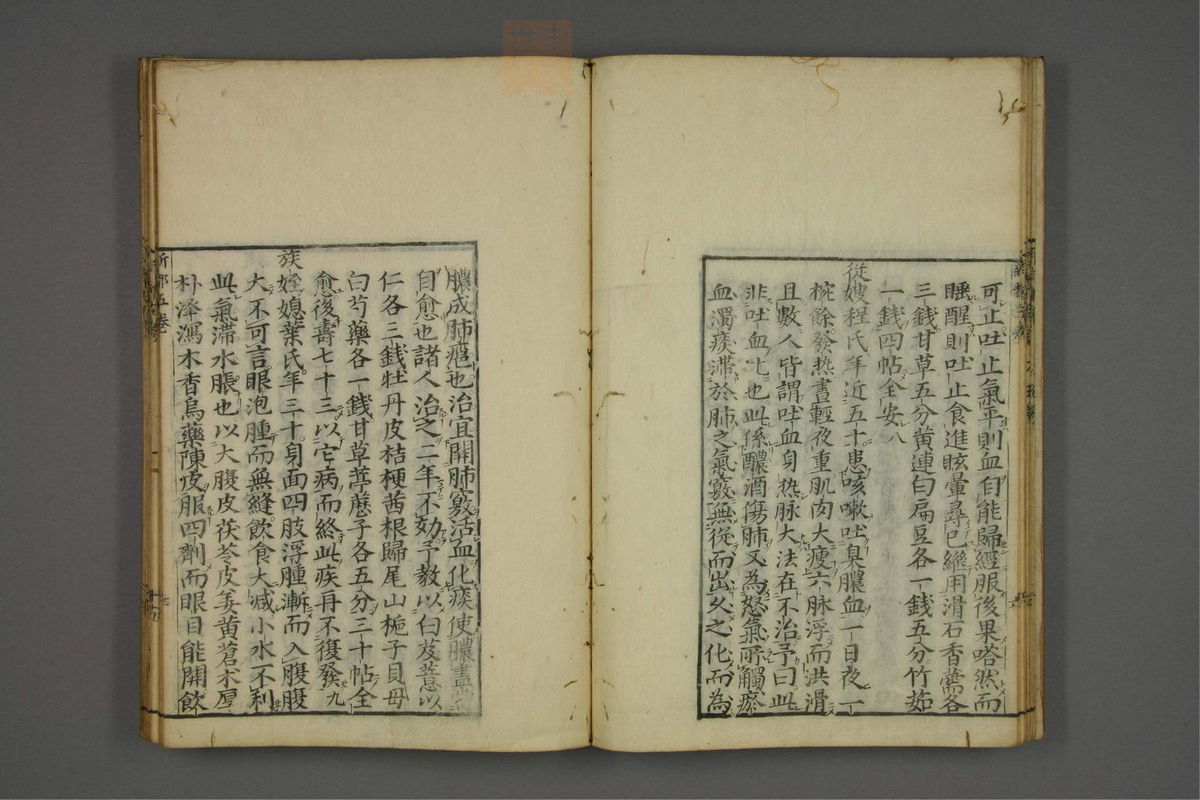 赤水玄珠(医案.第37-50卷)(第300页)