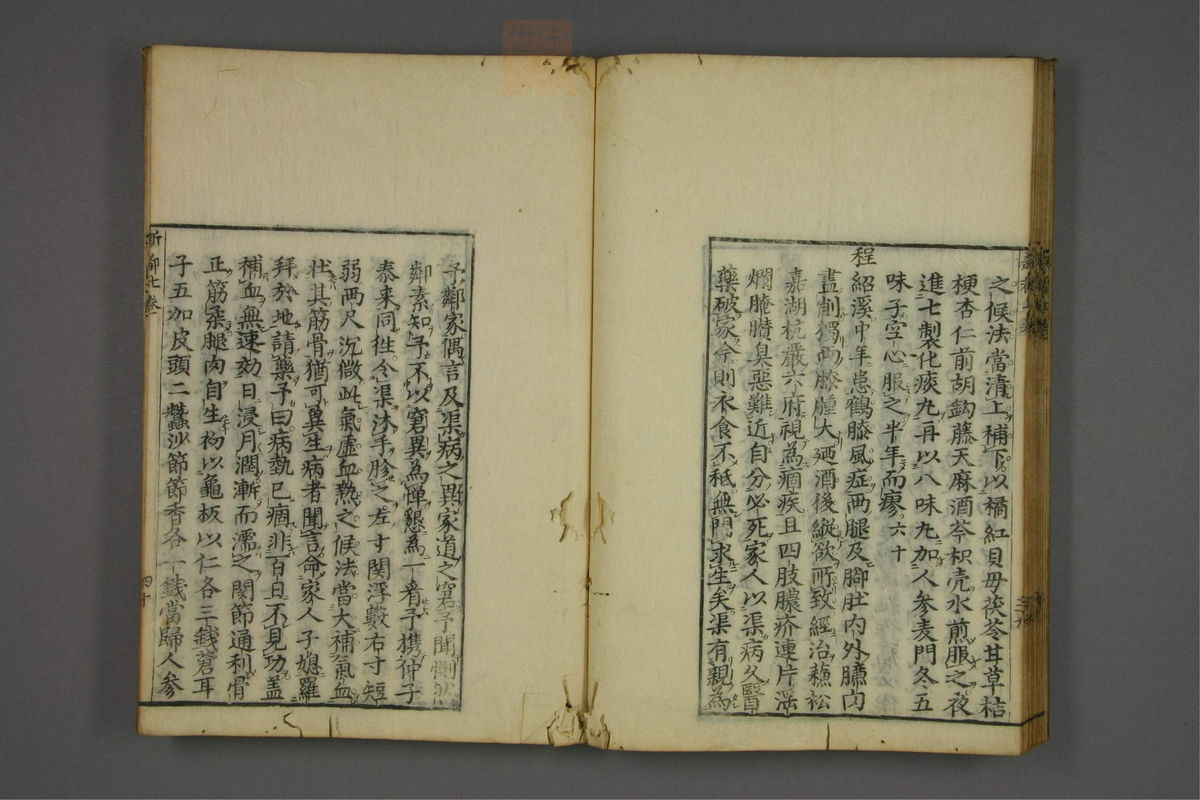 赤水玄珠(医案.第37-50卷)(第421页)