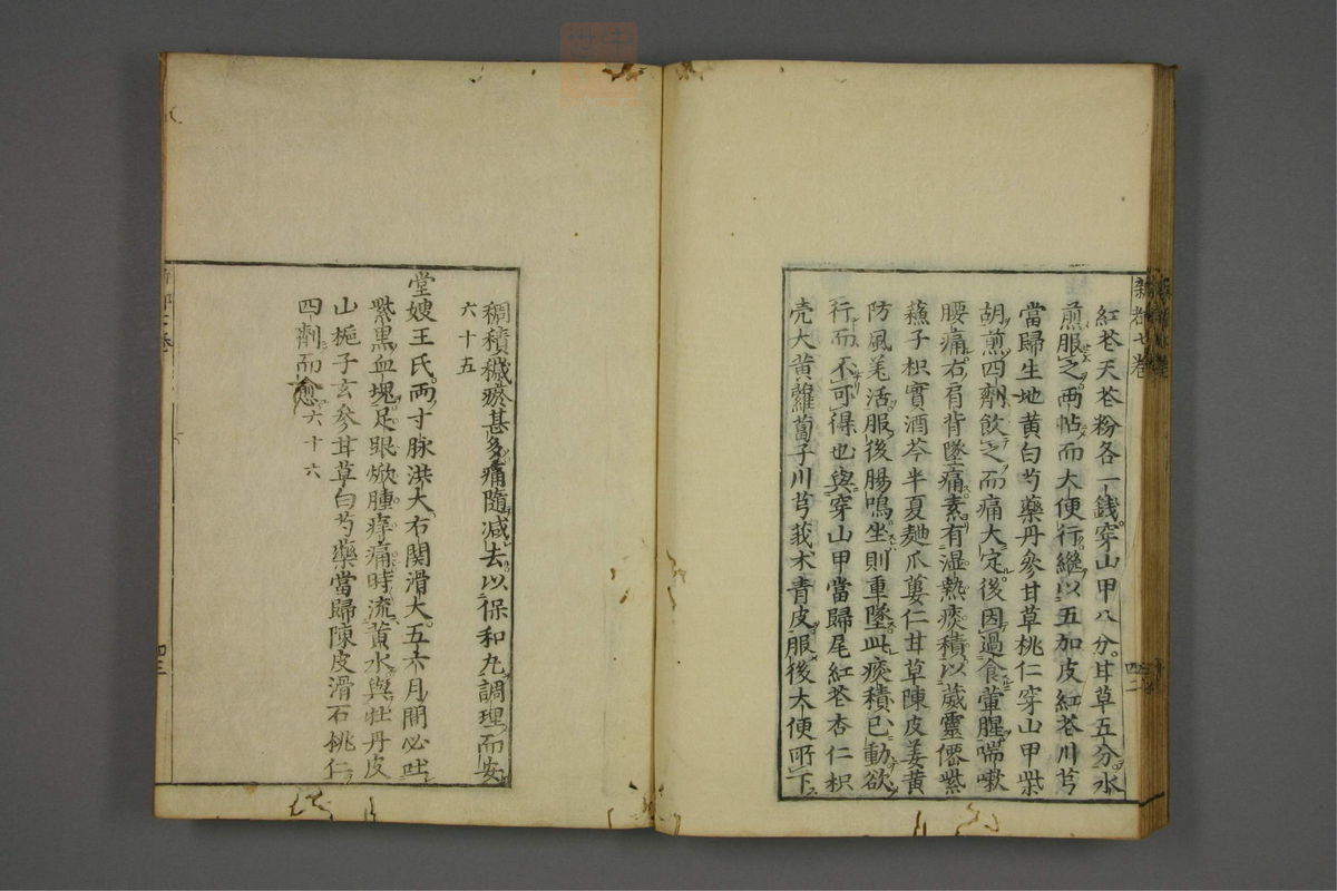 赤水玄珠(医案.第37-50卷)(第424页)