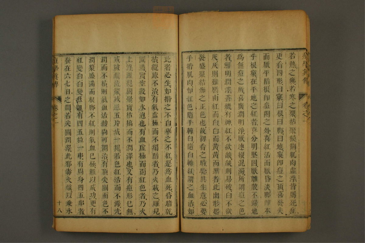 痘学真传(第30页)