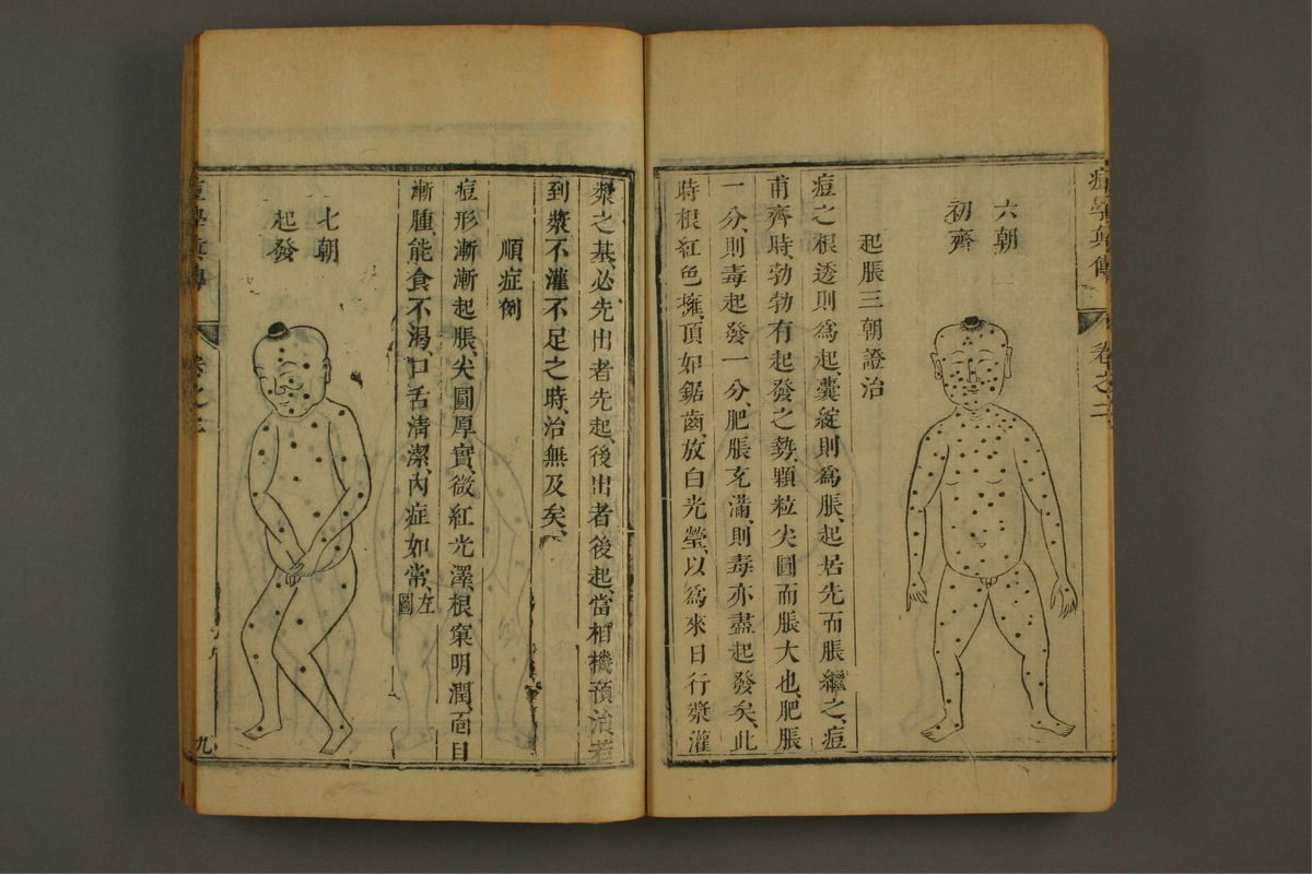 痘学真传(第92页)