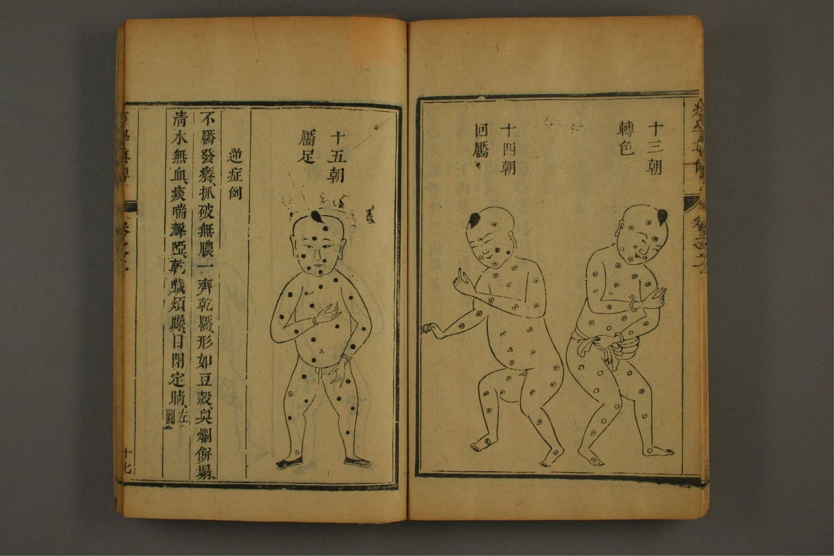 痘学真传(第100页)