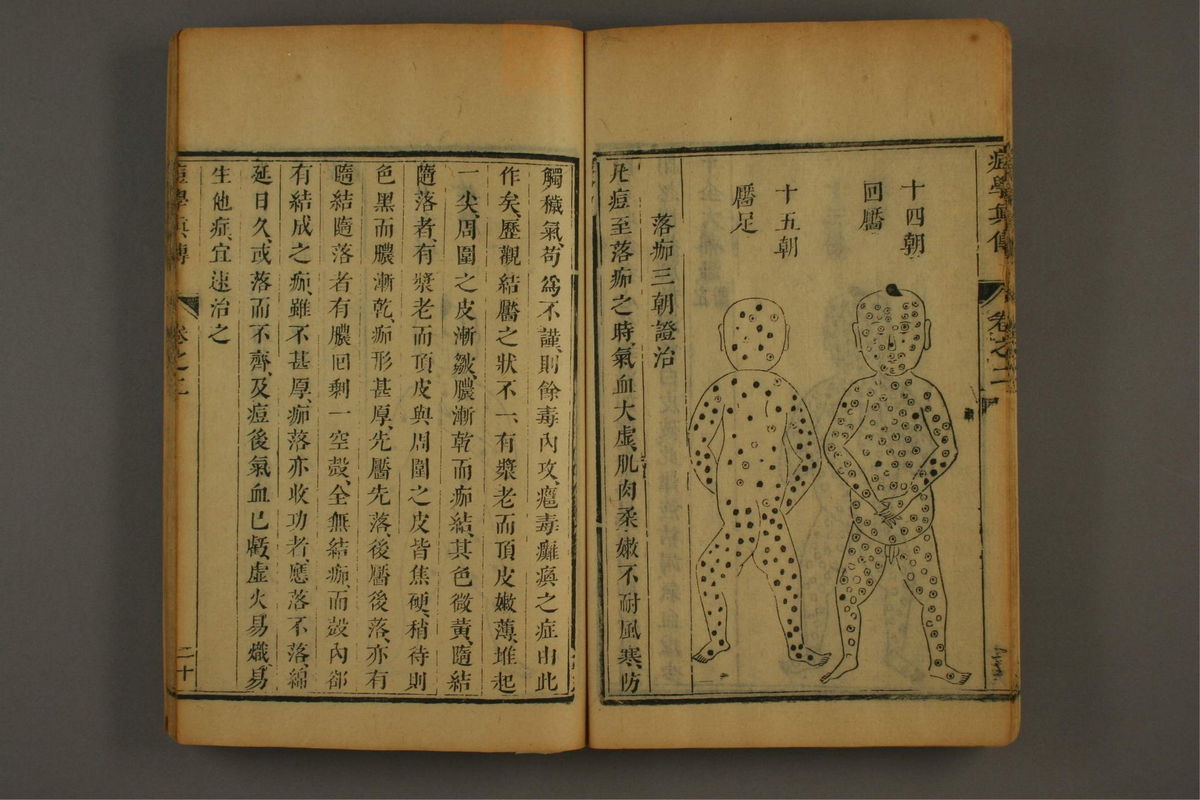 痘学真传(第103页)