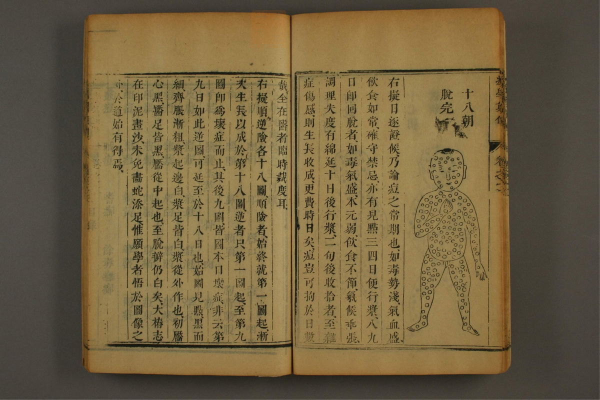 痘学真传(第107页)