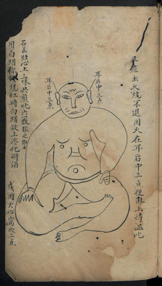 痘疹点烙及诊治(第11页)