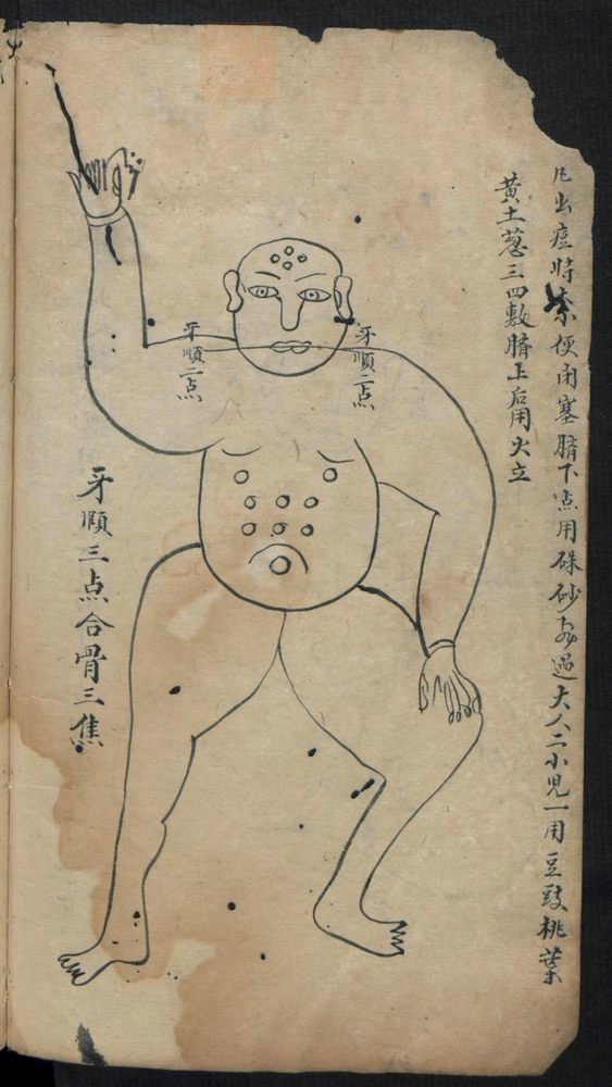 痘疹点烙及诊治(第12页)