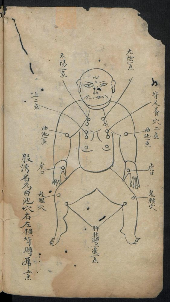 痘疹点烙及诊治(第14页)