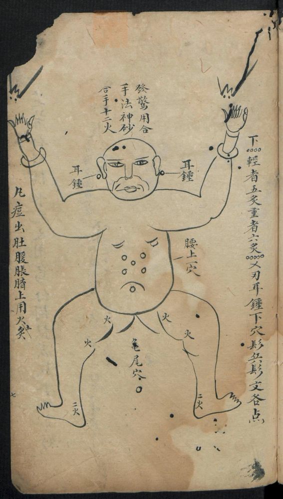 痘疹点烙及诊治(第15页)