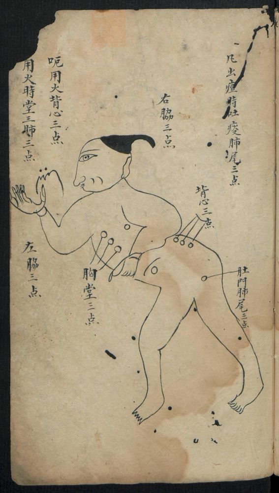 痘疹点烙及诊治(第17页)