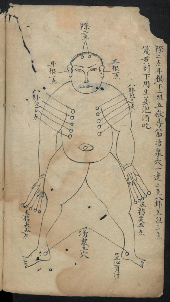 痘疹点烙及诊治(第18页)