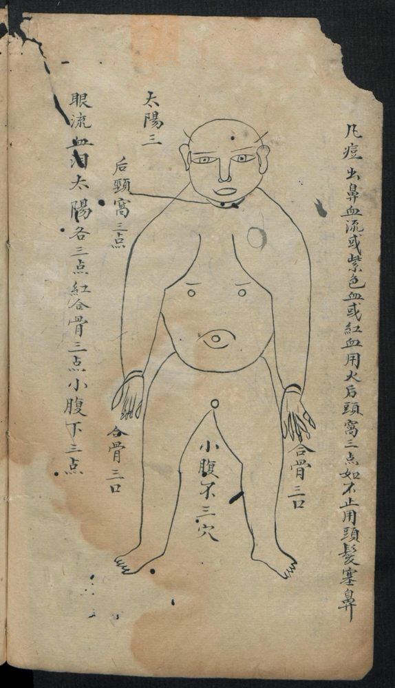 痘疹点烙及诊治(第20页)