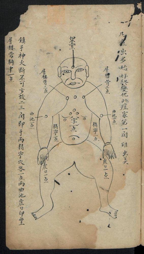 痘疹点烙及诊治(第21页)