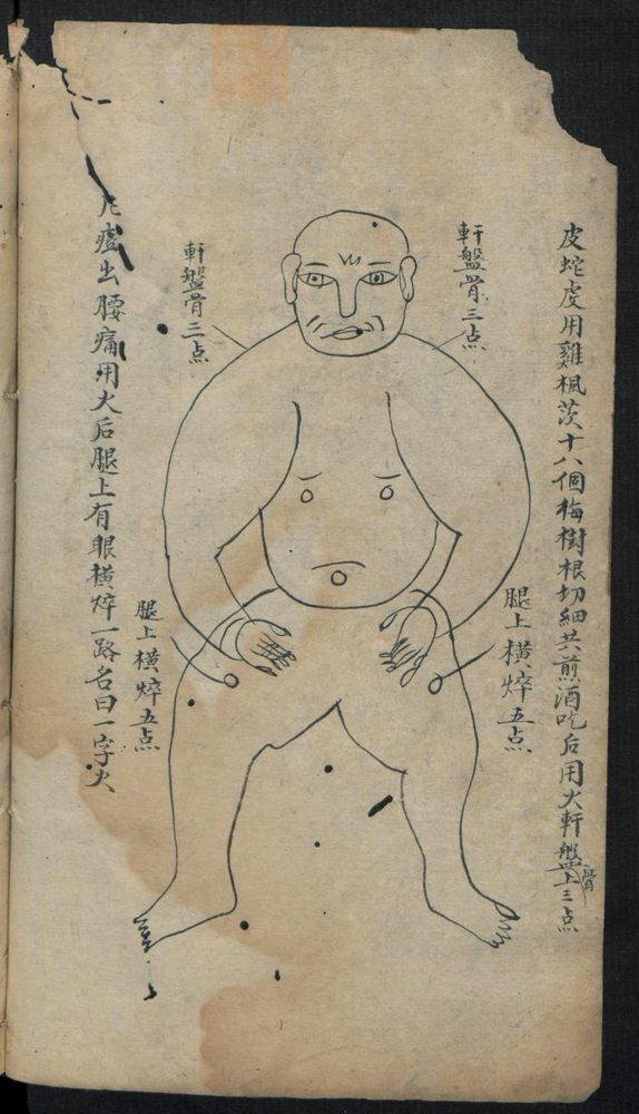 痘疹点烙及诊治(第22页)