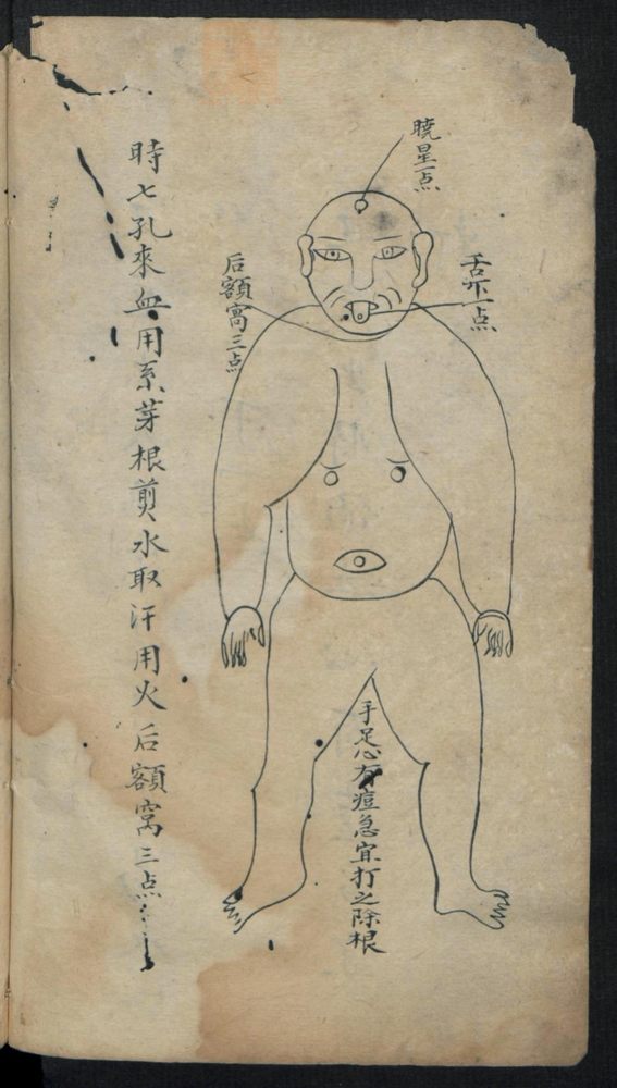 痘疹点烙及诊治(第24页)