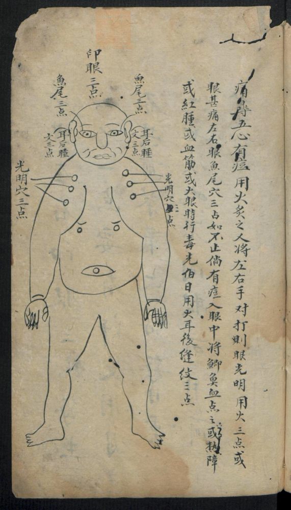 痘疹点烙及诊治(第25页)