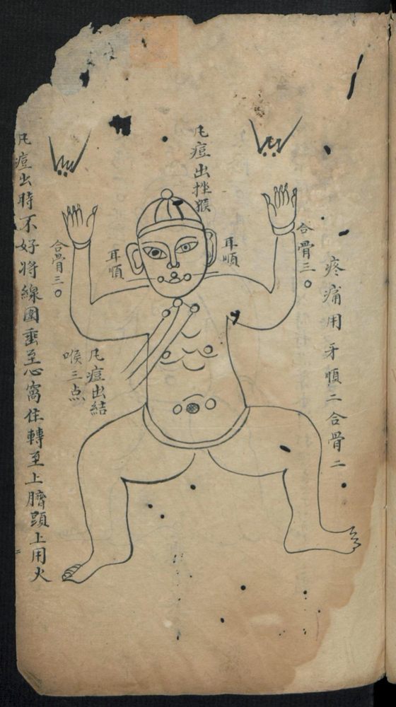 痘疹点烙及诊治(第5页)