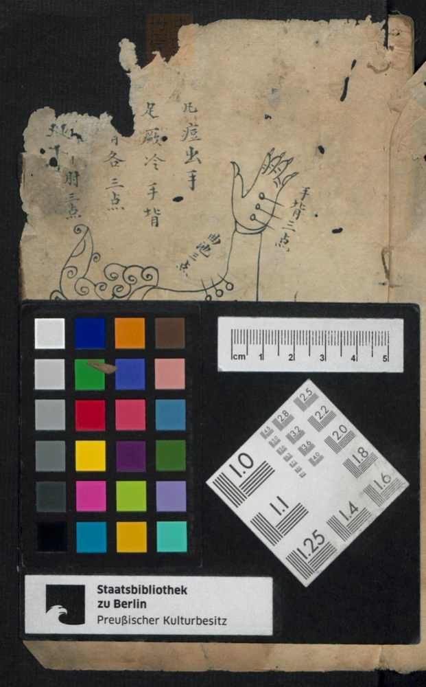 痘疹点烙及诊治(第77页)