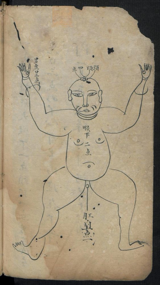 痘疹点烙及诊治(第8页)