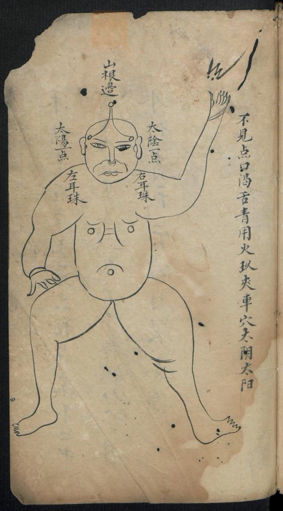 痘疹点烙及诊治(第9页)