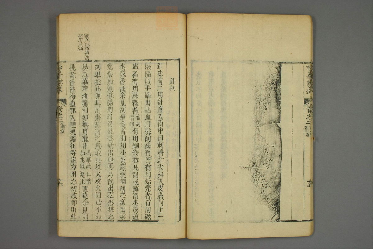 松峰说疫(第68页)