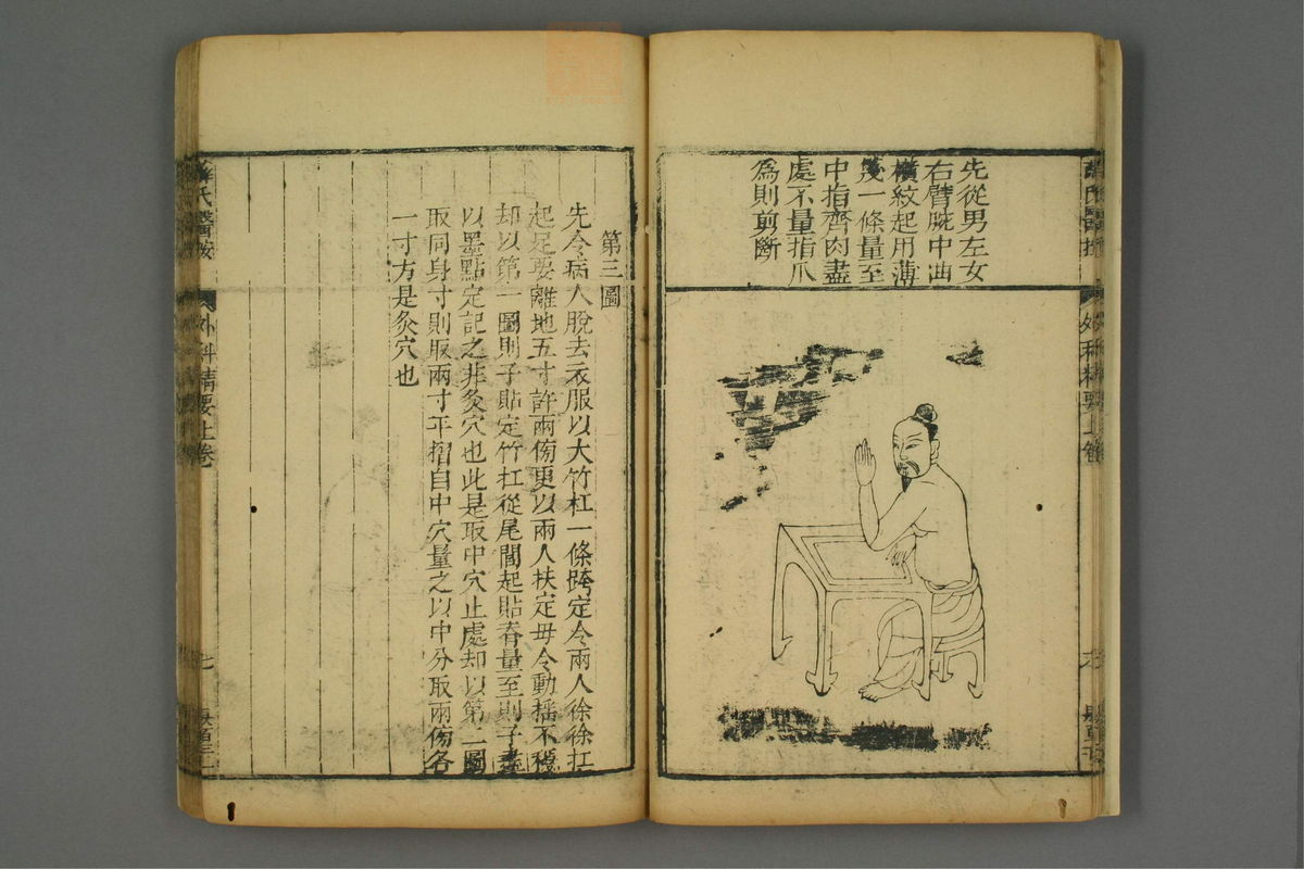 外科精要(第12页)