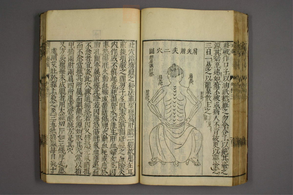 疡医准绳(第493页)