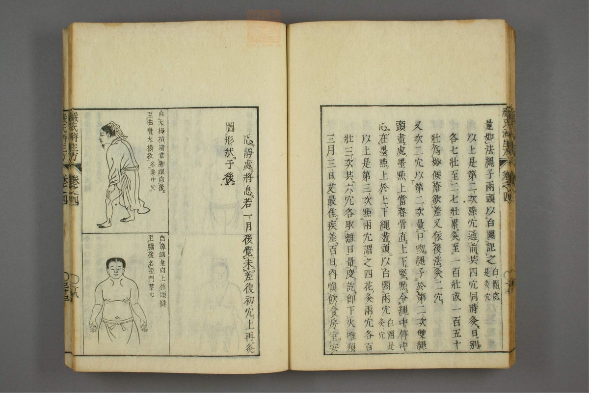 傷寒名數解(第106页)