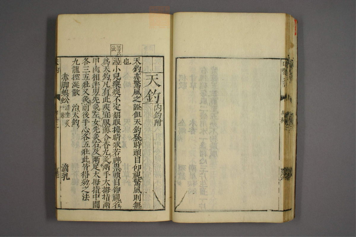 幼科证治准绳(第282页)