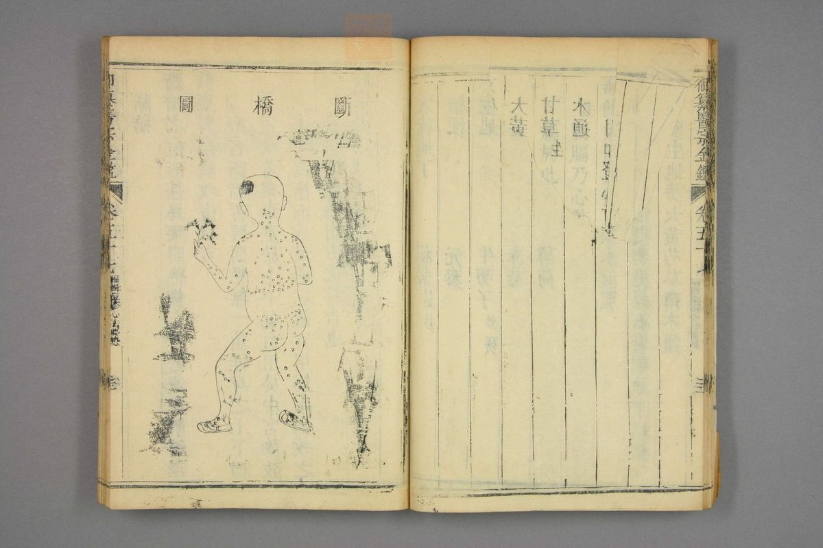 御纂医宗金鉴(第2720页)