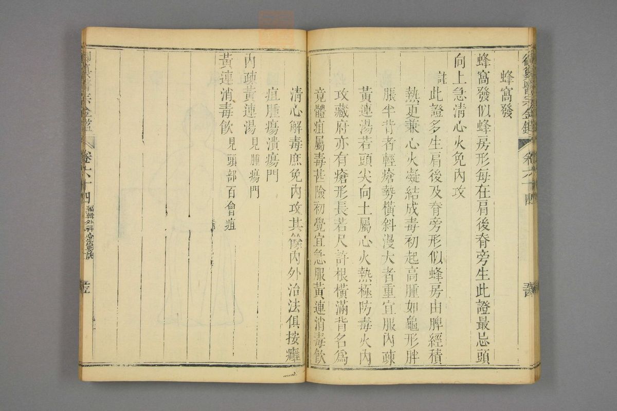 御纂医宗金鉴(第3169页)