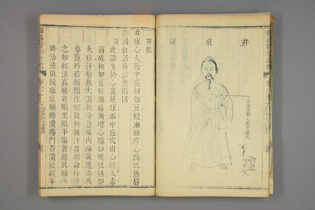 御纂医宗金鉴(第3303页)