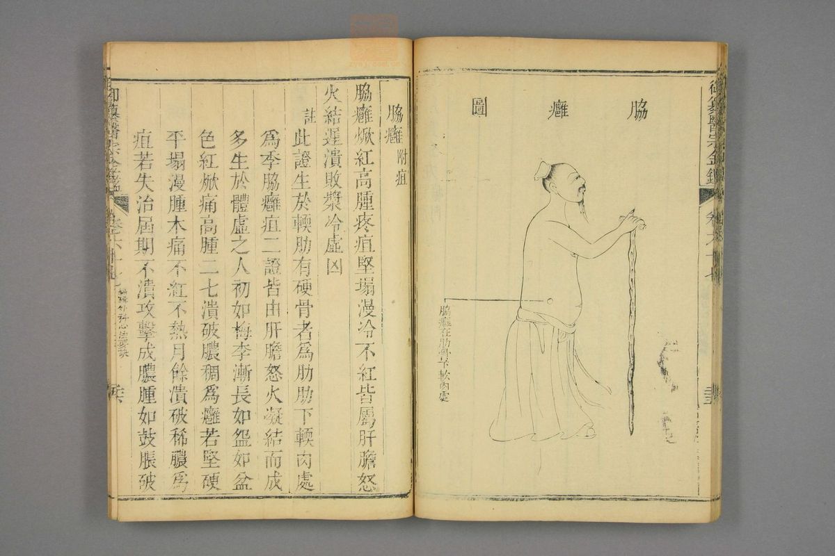 御纂医宗金鉴(第3353页)