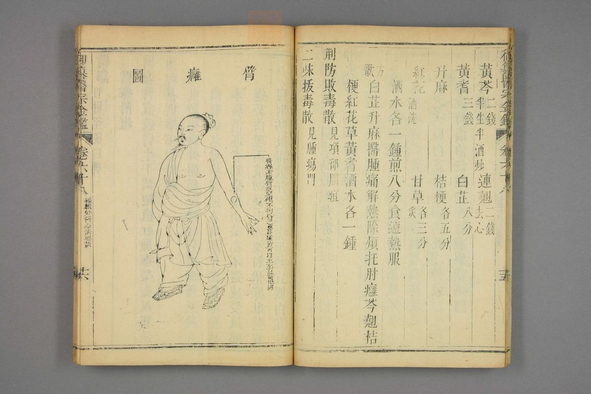 御纂医宗金鉴(第3393页)