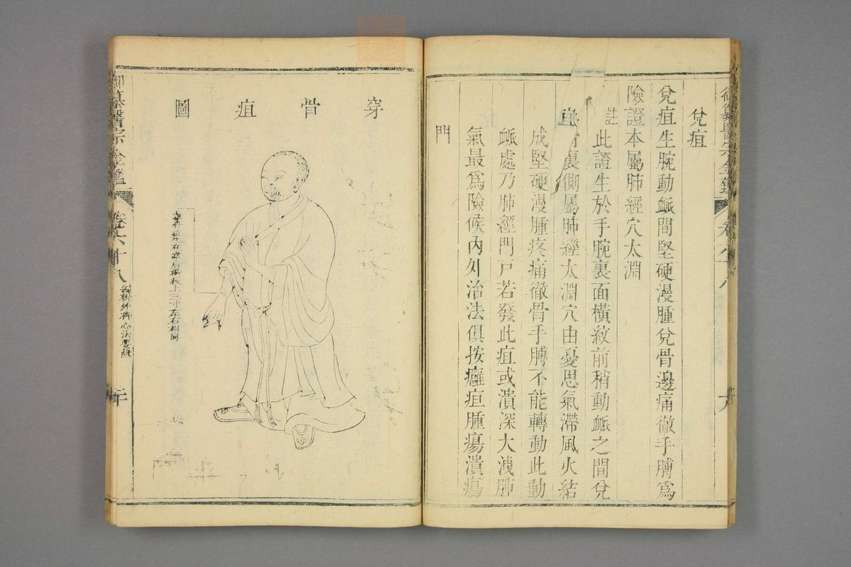 御纂医宗金鉴(第3397页)