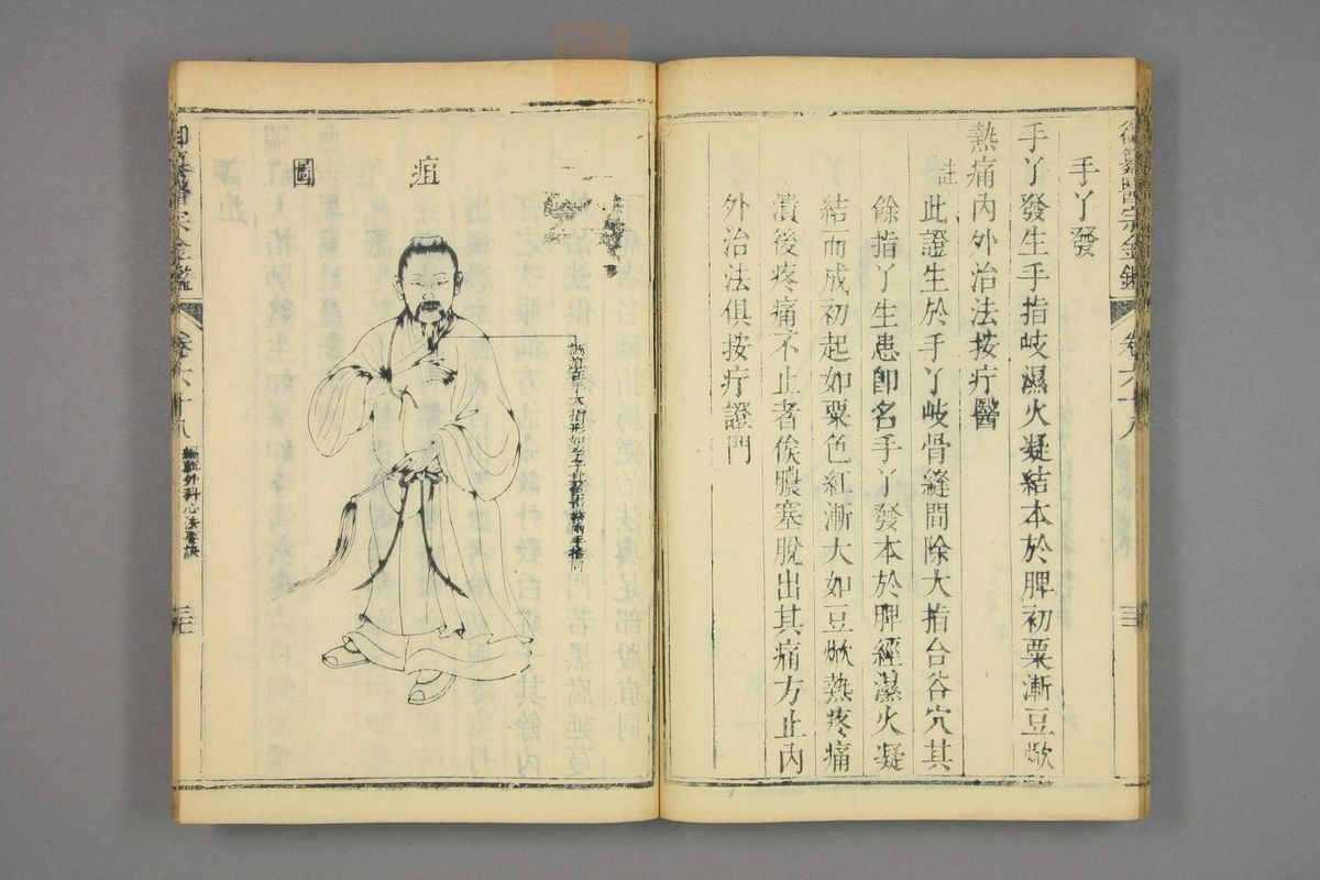 御纂医宗金鉴(第3408页)