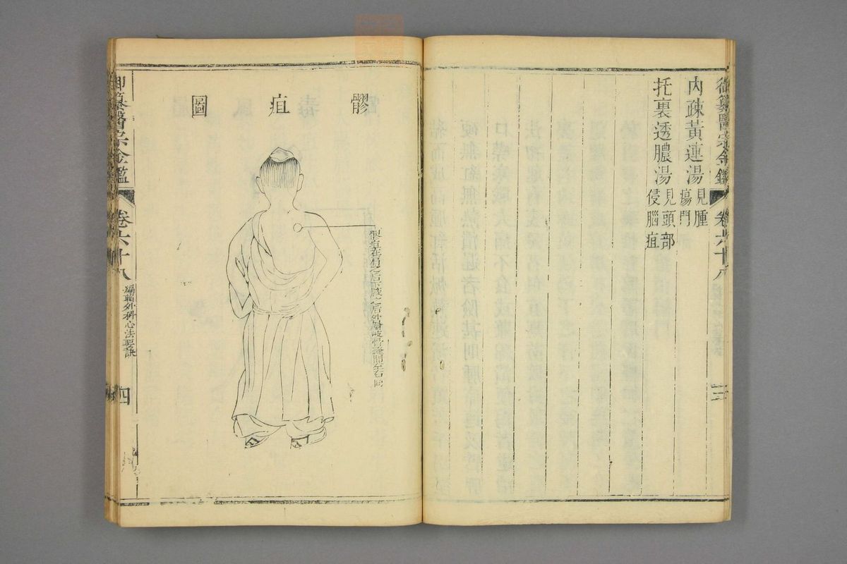 御纂医宗金鉴(第3381页)