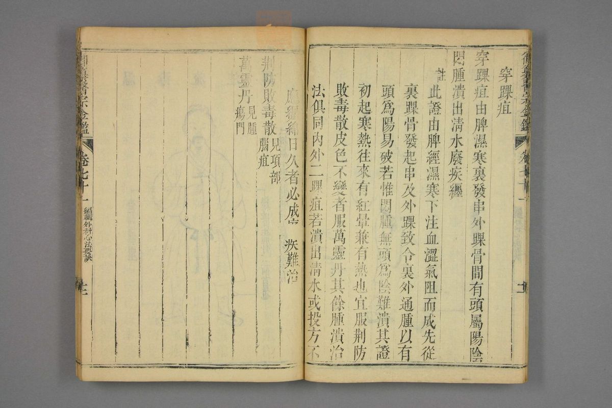 御纂医宗金鉴(第3533页)