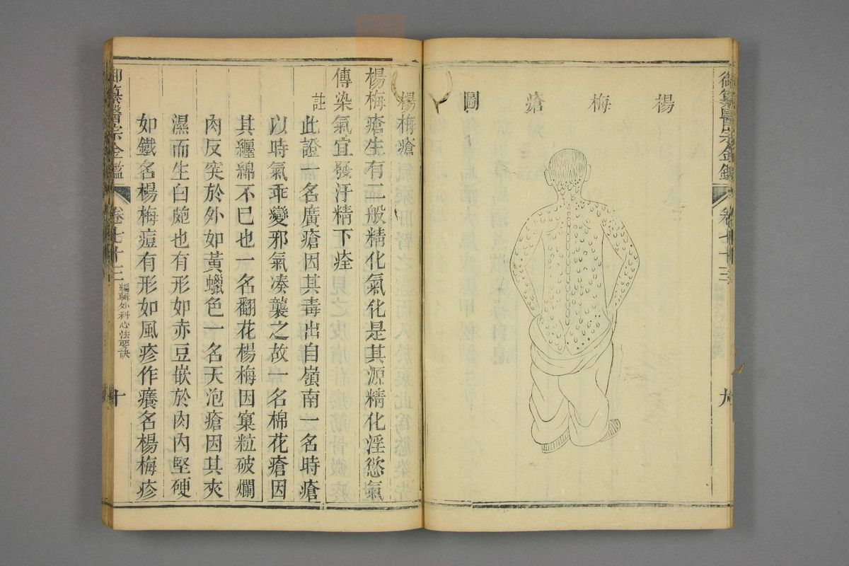 御纂医宗金鉴(第3636页)