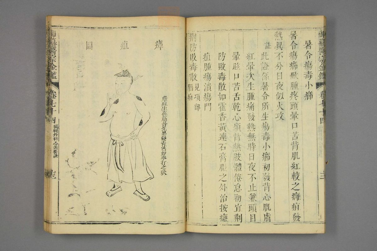 御纂医宗金鉴(第3682页)