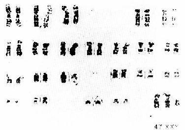 《病理学》_第一节 遗传病_中医世家